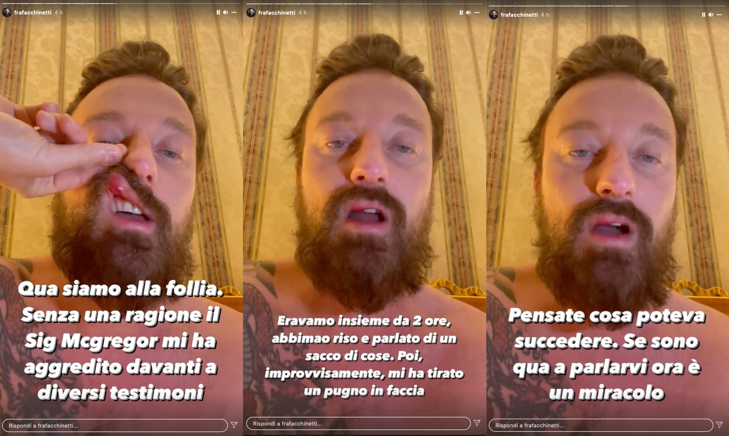 Francesco Facchinetti Mcgregor